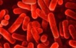 Preven��o Legionella 